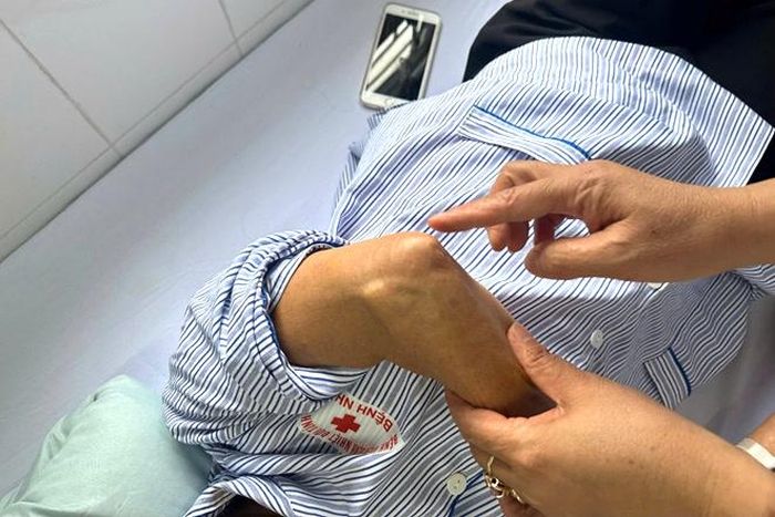 Vị trí ấu trùng sán lợn ký sinh gây đau buốt, sưng nhẹ. Ảnh: BVCC.