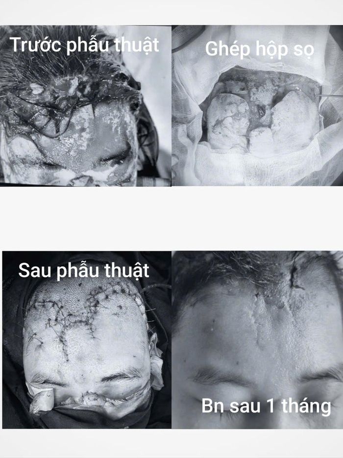 Tổn thương của bệnh nhân sau khi va chạm với xe công-ten-nơ và sau khi điều trị.