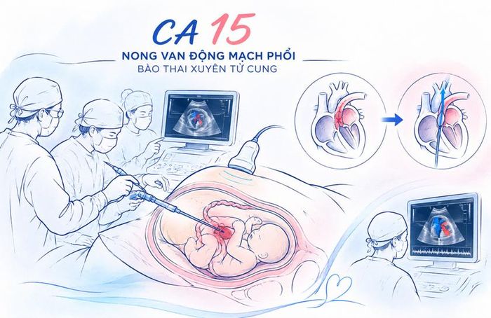Bệnh viện Từ Dũ và Bệnh viện Nhi Đồng 1 đã thực hiện thành công ca can thiệp tim bào thai xuyên tử cung thứ 15.