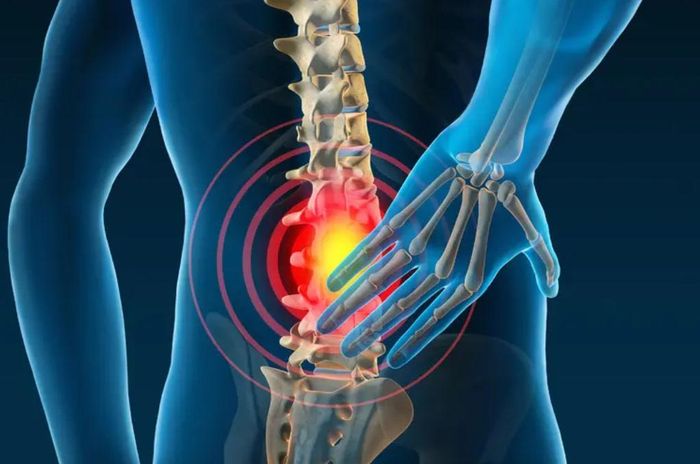 Đau lưng dưới có thể xuất phát từ nhiều nguyên nhân. Ảnh AI.