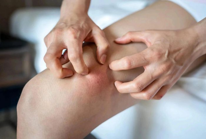  Ngứa da không chỉ đơn thuần là bệnh lý ngoài da mà là dấu hiệu cảnh báo gan tổn thương. Ảnh: Magnific. 