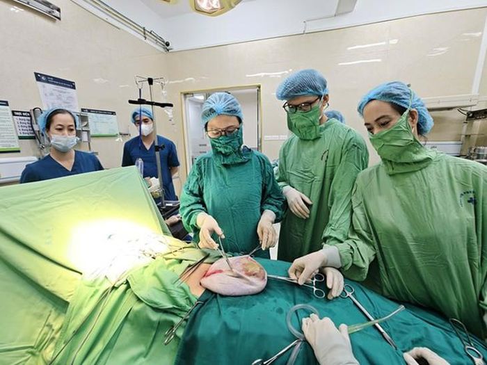 Khối u sau khi hút dịch được các bác sĩ Bệnh viện Phụ sản Hà Nội bóc tách lấy ra ngoài. Ảnh BVCC