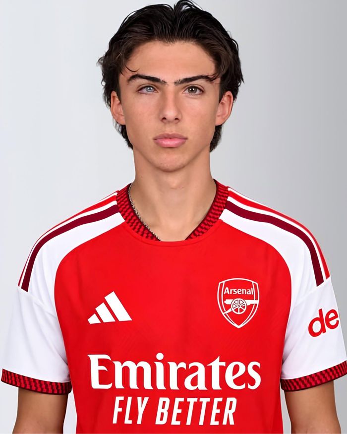 Gabriel Arteta gây chú ý với đôi mắt hai màu đặc biệt