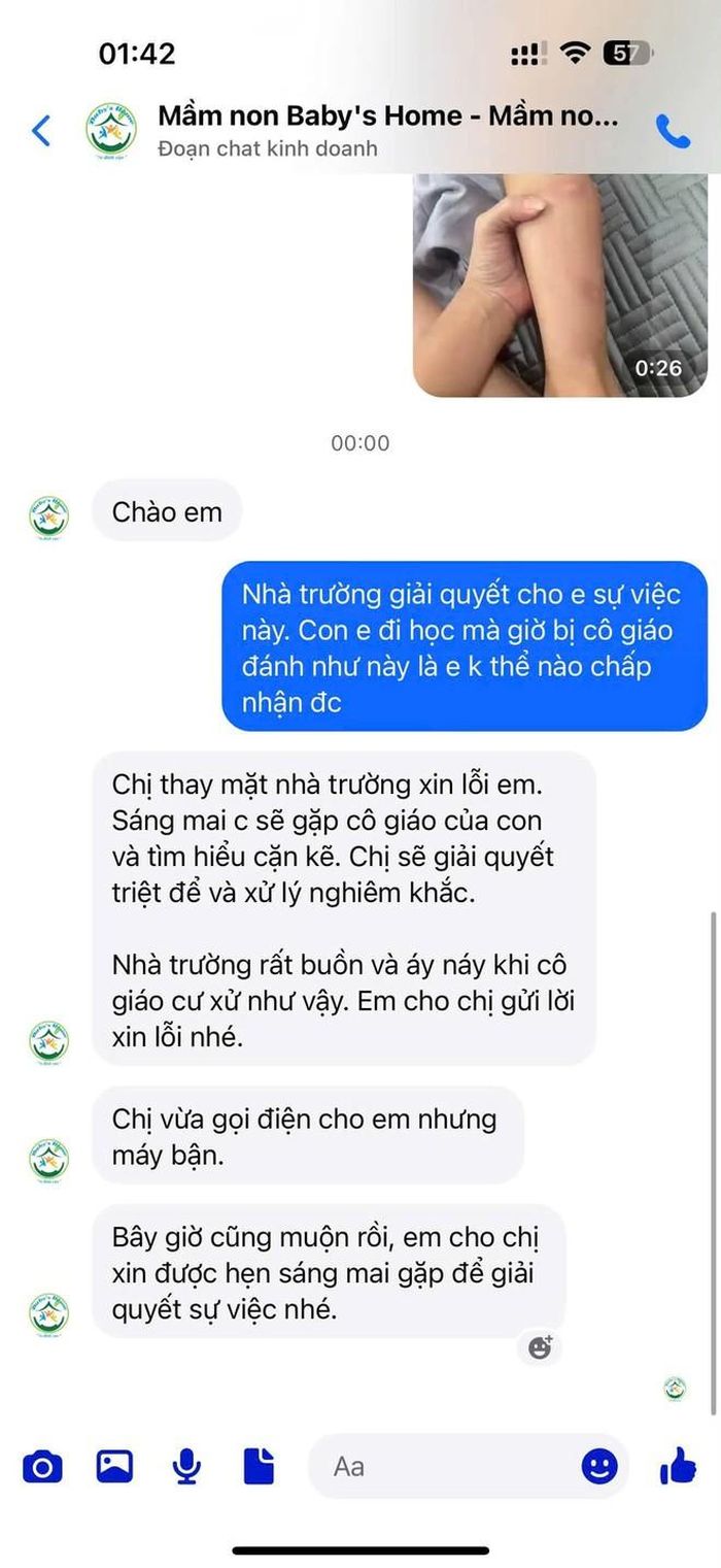 Hình ảnh chân bé T.V. bị giáo viên "tác động vật lý". Ảnh: PHCC
