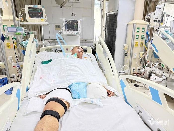 Tai nạn nghiêm trọng khiến Doanh phải cắt bỏ một bên chân trái
