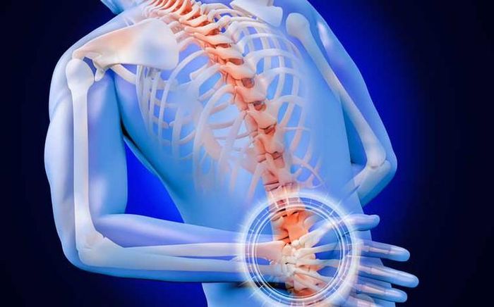 Viêm cột sống dính khớp là bệnh viêm hệ thống mạn tính, với tổn thương chủ yếu ở khớp cùng chậu, cột sống và các khớp trục. Ảnh AI
