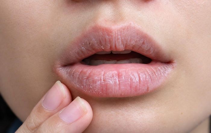 Khô miệng gây nhiều phiền toái trong đời sống có thể là do nhiều nguyên nhân gây ra. Ảnh: Magnific.
