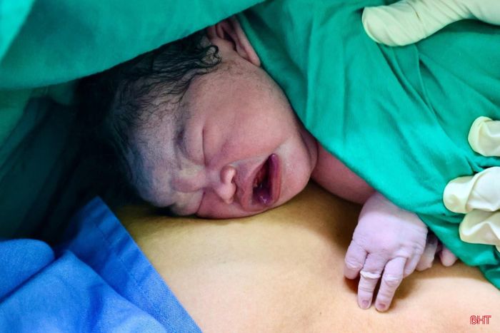 Một bé gái nặng 3kg ra đời trong niềm vui mừng, hạnh phúc của các y, bác sỹ và gia đình sản phụ. Sau khi chào đời, em bé được nhân viên y tế đặt trên ngực mẹ với phương pháp da kề da.