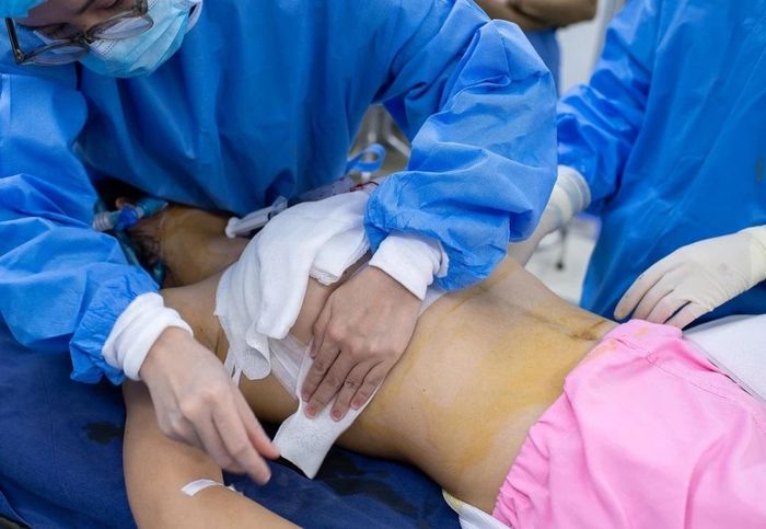 Bác sĩ nâng ngực cho bệnh nhân tại một bệnh viện tại Hà Nội. Ảnh minh họa: Việt Linh.