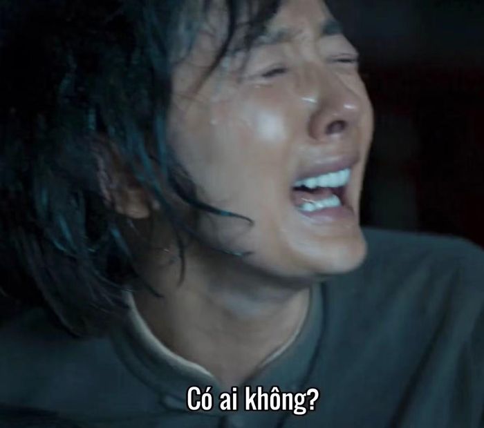 Hàm răng trắng của các nghệ sĩ khiến khán giả khó chịu khi xem phim.
