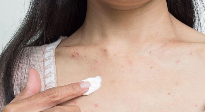 Ngành công nghiệp chăm sóc da chống ô nhiễm là một thị trường có giá trị lên tới hàng tỷ USD. Ảnh: The London Dermatology Centre