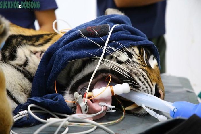 Việc gây mê hoặc thực hiện thủ thuật chuyên sâu được thực hiện bởi đội ngũ chuyên gia có thiết bị theo dõi và phương án hồi phục an toàn.