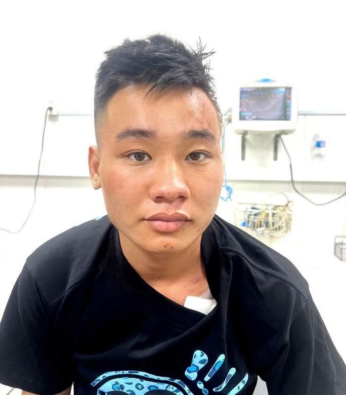 Nguyễn Đức Anh. Ảnh: Công an TP Đồng Nai.