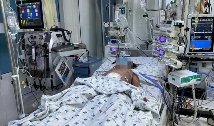 Bệnh nhi phải lọc máu liên tục. Ảnh: BVCC.