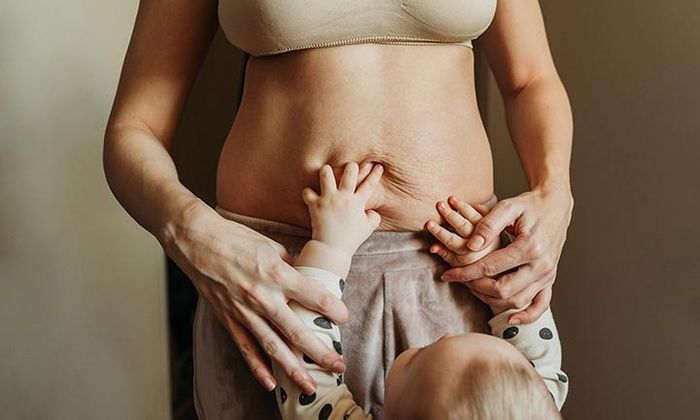 Xổ bụng sau sinh (vùng bụng bị phình to, chảy xệ, lỏng lẻo dù đã giảm cân) là hiện tượng rất phổ biến ở phụ nữ. Ảnh: Pampers.