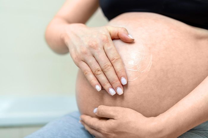 Rạn da sau sinh thường xuất hiện ở bụng, ngực, đùi, hông và có thể cải thiện bằng nhiều phương pháp tùy tình trạng tổn thương. Ảnh: Magnific.