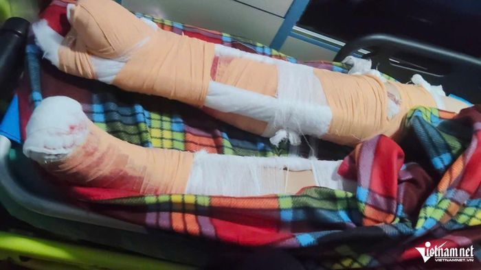Hai chân của cô Hiền bị xe tải cán nát sau tai nạn, theo người nhà, chân phải của cô Hiền chỉ còn khoảng 5% khả năng sống nên buộc phải cắt bỏ
