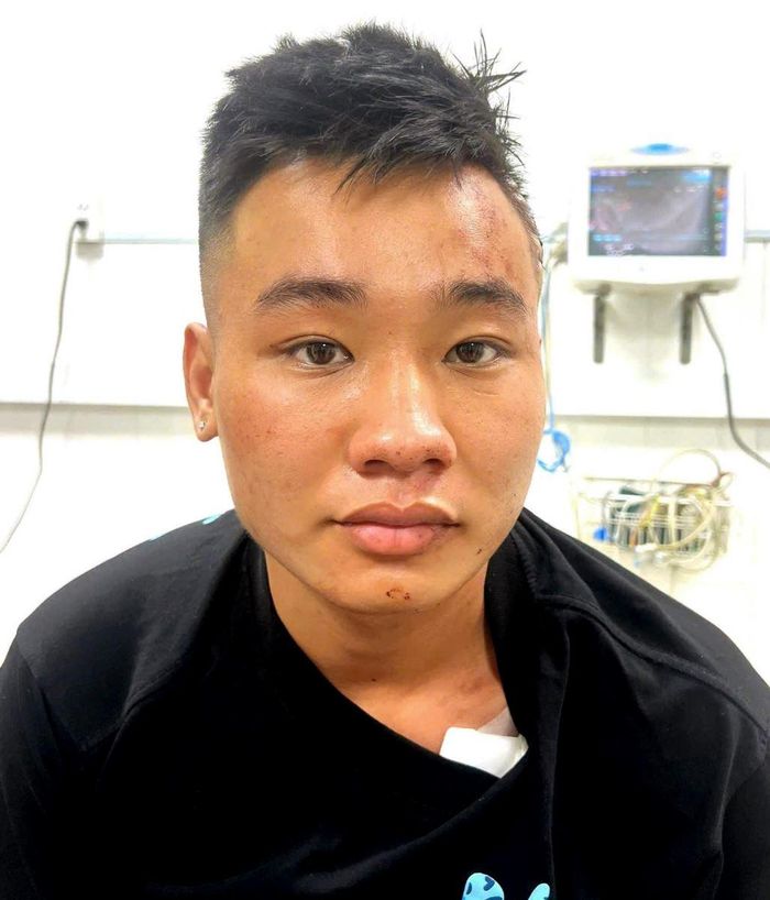 Nguyễn Đức Anh, 21 tuổi, ngụ phường Hố Nai, Thành phố Đồng Nai, bị khởi tố, bắt tạm giam để điều tra về hành vi Giết người. Ảnh: Công an Đồng Nai
