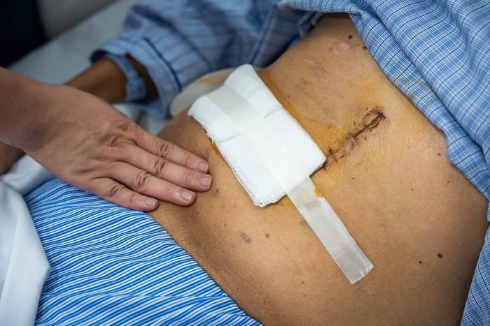  Nhận biết sớm, ăn uống lành mạnh, vận động và bỏ thuốc lá giúp giảm nguy cơ. Ảnh: Đinh Hà. 