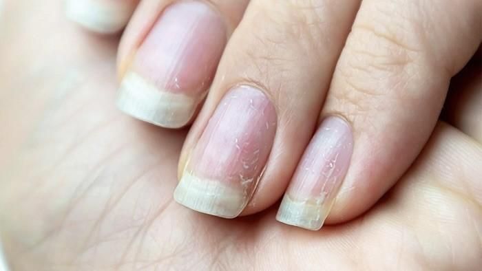 Tuy nhiên nếu thấy móng mỏng hơn, giòn hơn và xuất hiện màu sắc bất thường thì bạn nên ngừng làm móng một thời gian. Ảnh minh họa
