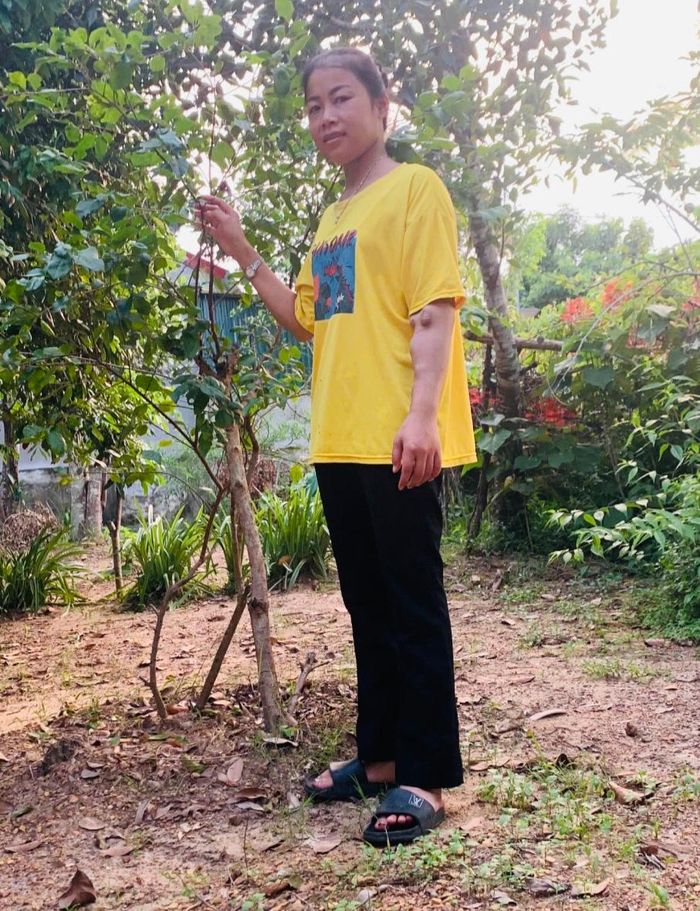Chị Thuý duy trì sự sống nhờ máy lọc máu. Ảnh: NVCC.