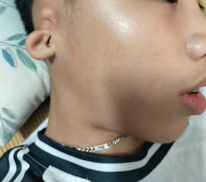 Hình vùng tai của trẻ bị biến đổi bởi dị tật bẩm sinh. Ảnh: P.Anh