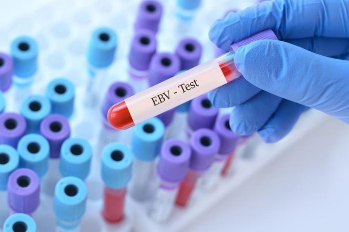Virus EBV chủ yếu lây qua nước bọt. Ảnh: Shutterstock.