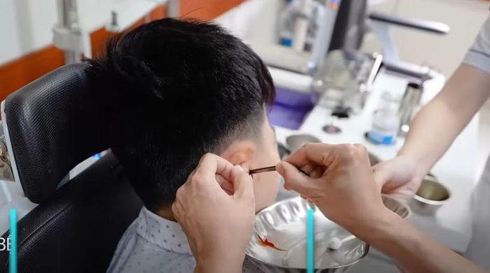 Bác sĩ xử lý dịch trong tai cho bệnh nhân - Ảnh cắt từ video BVCC