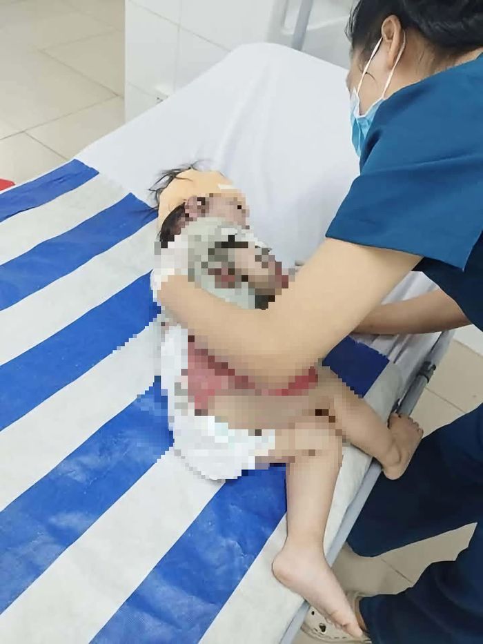 Bé gái hiện đang được theo dõi chăm sóc sức khoẻ tại bệnh viện.