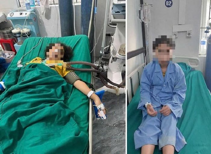 Hình ảnh bệnh nhi 12 tuổi được cấp cứu và theo dõi điều trị tại bệnh viện. Ảnh: BVCC.