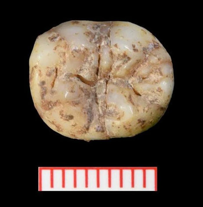 Răng của người Denisovan có những rãnh và gờ đặc trưng riêng của loài này. (Ảnh: CNN)