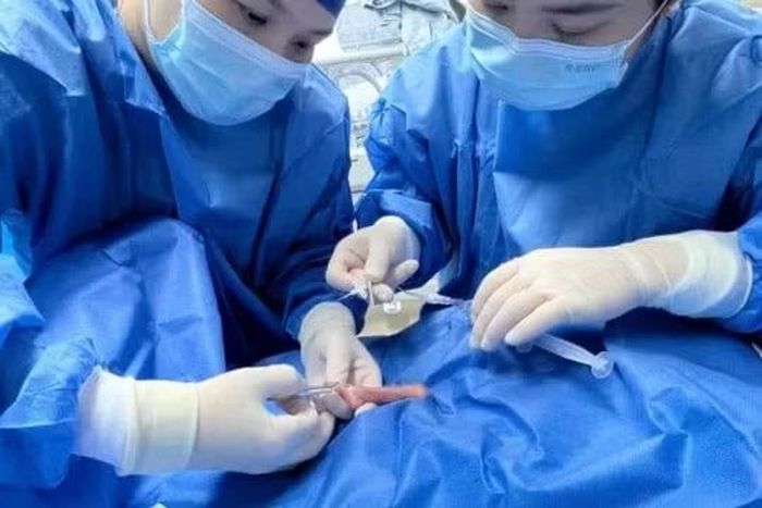 Em bé được cứu sống được coi là kỳ tích