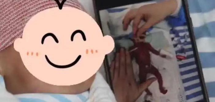 Bé sơ sinh chào đời khi mới được 23 tuần 4 ngày