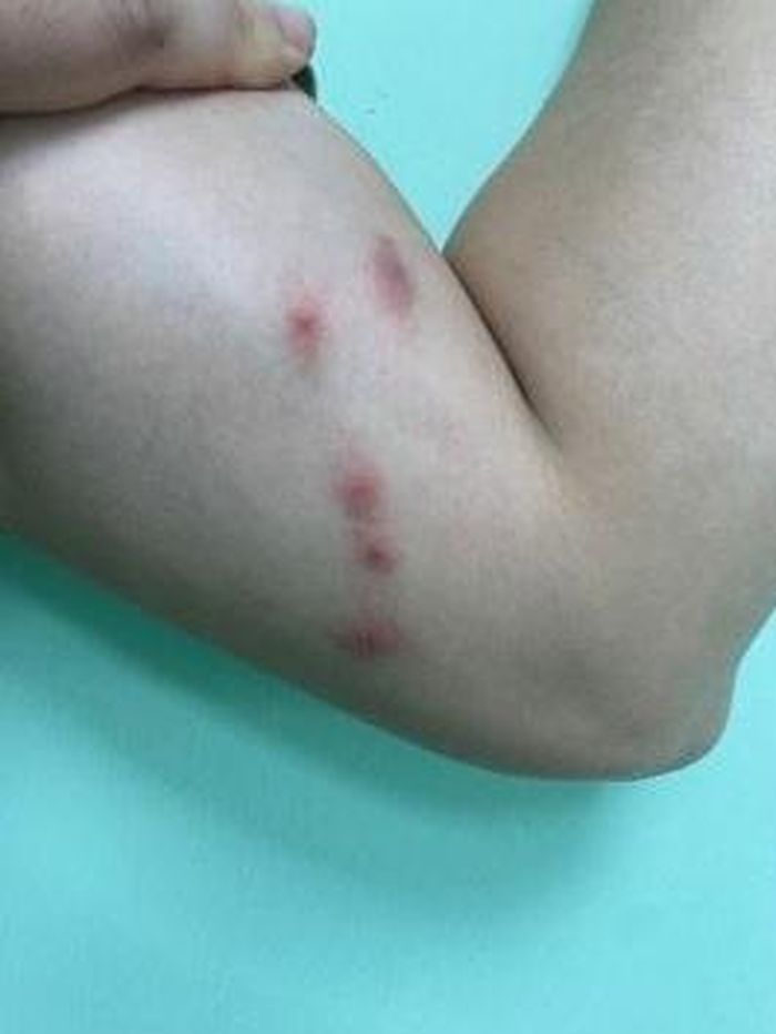  Ảnh lâm sàng của người bệnh khi đến khám. Ảnh: BVCC. 