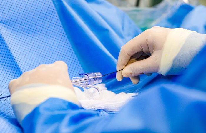Các bác sĩ can thiệp cho bệnh nhân. Ảnh: BHT.