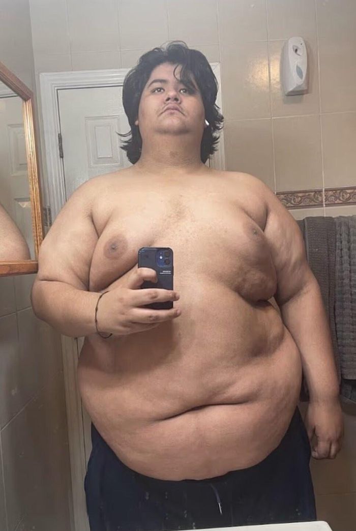 David John Castaneda khi nặng hơn 200kg ở tuổi 19. Ảnh: Jam Press