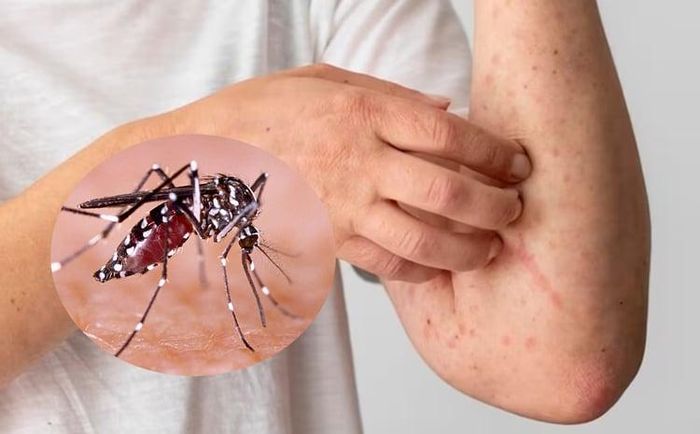Người dân thường mắc một số sai lầm khiến việc phát hiện và theo dõi bệnh bị chậm trễ (Ảnh minh họa)