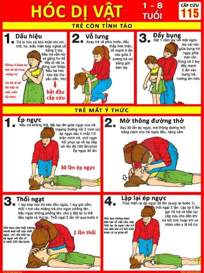 Cách sơ cứu trẻ bị hóc dị vật (Ảnh: suckhoedoisong).