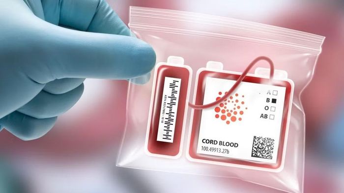 Máu cuống rốn được biết đến là nguồn tạo tế bào gốc có thể lập trình đa năng.