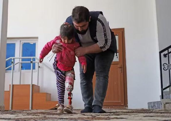 Bé gái 7 tuổi Salwa al Raslan, ở tỉnh Idlib, Syria, bị mất chân trái do giẫm phải mìn, được lắp chân giả in 3D. Ảnh: El Pais