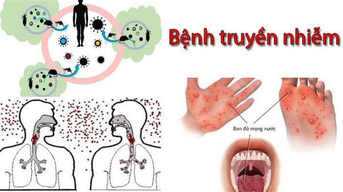 Bệnh truyền nhiễm là những bệnh do các tác nhân gây bệnh như vi khuẩn, virus, ký sinh trùng hoặc nấm gây ra. Ảnh minh họa