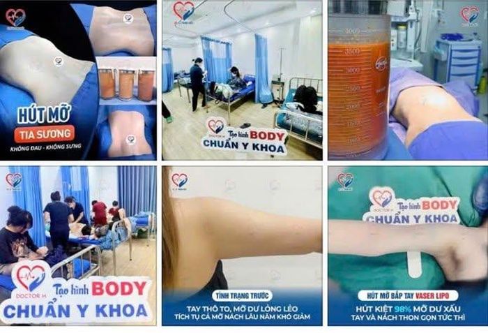  Một số hình ảnh quảng cáo của cơ sở thẩm mỹ Julia Aesthetic. Ảnh: CAHN