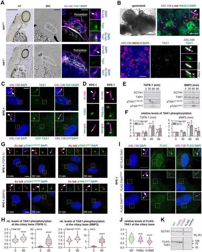 TAK1 tập trung tại primary cilium trong tế bào tim của cá ngựa vằn và trong các tế bào tiền thân tim.