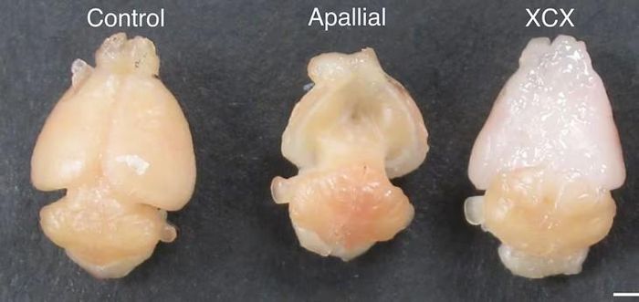 Não của chuột đối chứng (trái), chuột "apallial" bị thiếu phần lớn vỏ não (giữa) và chuột "xenocortical" được cấy ghép mô não người. Ảnh: Kaganovsky và các cộng sự, Nature