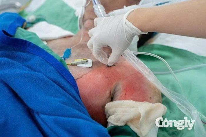 Các nạn nhân trong vụ cháy nhà đang được điều trị tích cực tại bệnh viện.