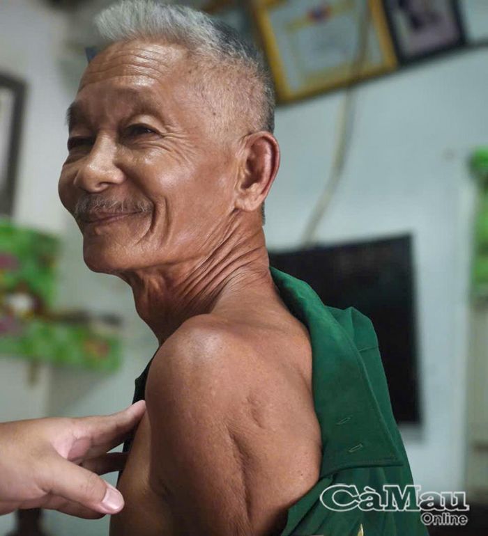  Ông Trần Hoàng Minh (thương binh 4/4, ấp Trùm Thuật B, xã Khánh Hưng) sức khoẻ suy giảm do vết thương chiến tranh và tuổi già.