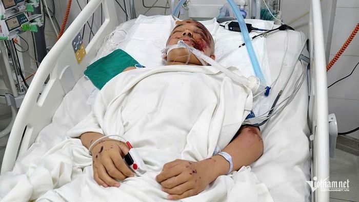 Tai nạn nghiêm trọng khiến Quang bị đa chấn thương nặng