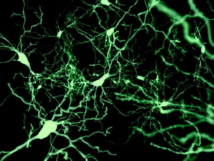 Các tế bào Sst-Chodl tuy rất hiếm nhưng có mạng lưới kết nối rộng trong não. Ảnh: Juan Gaertner/Science Photo Library.