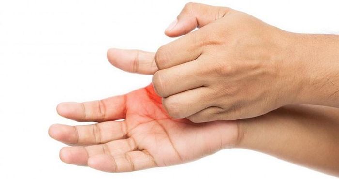 Ngứa lòng bàn tay, bàn chân kéo dài có thể liên quan đến bệnh gan. Ảnh minh họa