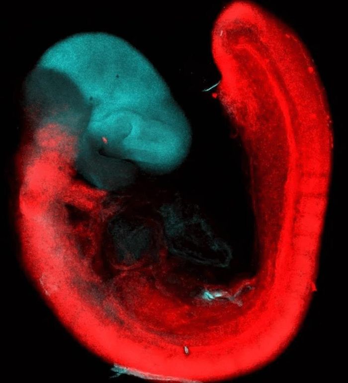 Hình ảnh quét não của phôi chuột 9,5 ngày tuổi cho thấy sự phát triển của hai cơ quan. Ảnh: Stanford Medicine/Loh Laboratory